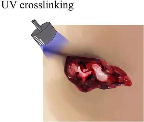 Depicts hydrogel application process.