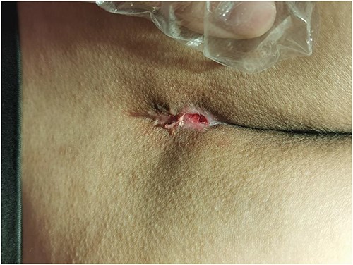 Depict wound healing.