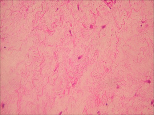 The same area in higher magnification (H & E ×200).