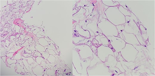 Case 2: hematoxylin and eosin.