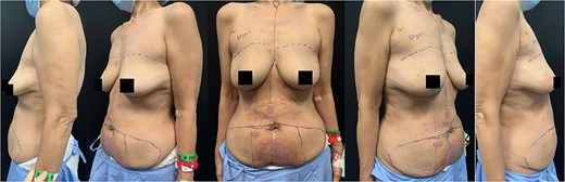 Pre-operative photos.