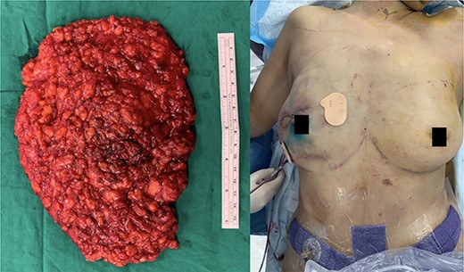 Intra-operative photos.