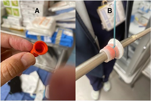 (A) Sterile hemostatic red cap from a 21 Fr Edwards Thruport EndoReturn arterial cannula; (B) Ethibond suture