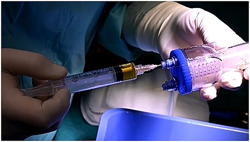 Prp in thrombinator.