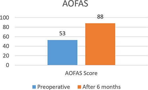 Pre and postoperative AOFAS score.