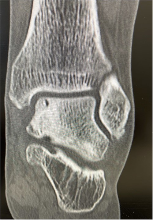 Post-op Patient 2.