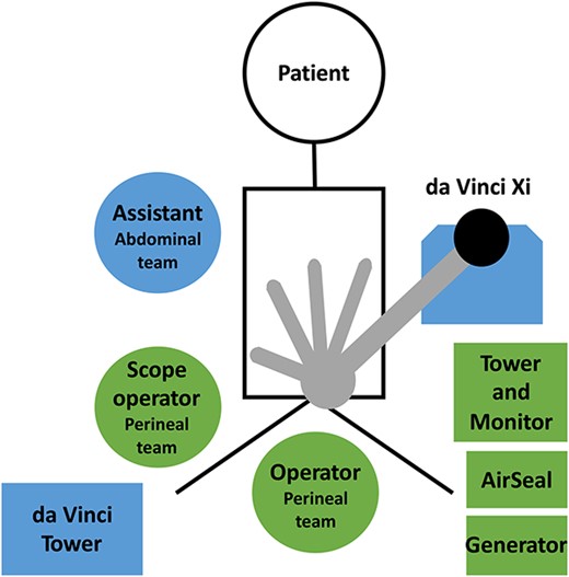 The operating room settings for the hybrid surgery. The da Vinci Xi is rolled from the left side of the patient. The assistant in the abdominal team is positioned on the right side of the patient. The operator in the perineal team is positioned between the patient’s legs. The scope operator stands on the outer side of the right leg. The tower and monitor, AirSeal, and generator in the perineal team are located on the left side of the patient and on the caudal side of the da Vinci Xi.