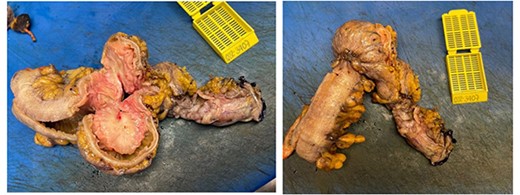 Macroscopic findings.