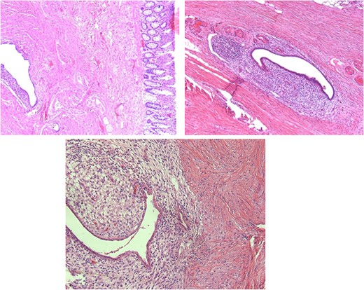 Microscopic histopathological findings.