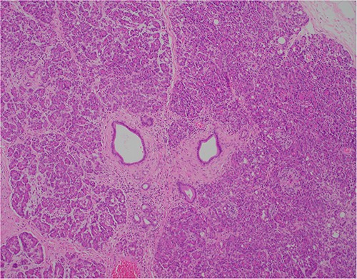 ×10 objective lens; showing central duct with surrounding pancreatic acini and islets, with preserved architecture.