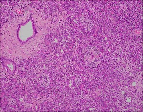 ×20 objective lens; normal duct towards left hand side; acini (with dense pink cytoplasmic granules) and islets (clusters of pale cells).