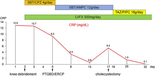 Timeline of antibiotic and surgical treatment, and changes in the C-reactive protein level. CRP, C-reactive protein; ERCP, endoscopic retrograde cholangiopancreatography; LVFX, levofloxacin; PTBD, percutaneous transhepatic biliary drainage; SBT/AMPC, sulbactam/ampicillin; SBT/CPZ, sulbactam/cefoperazone; TAZ/PIPC, tazobactam/piperacillin.