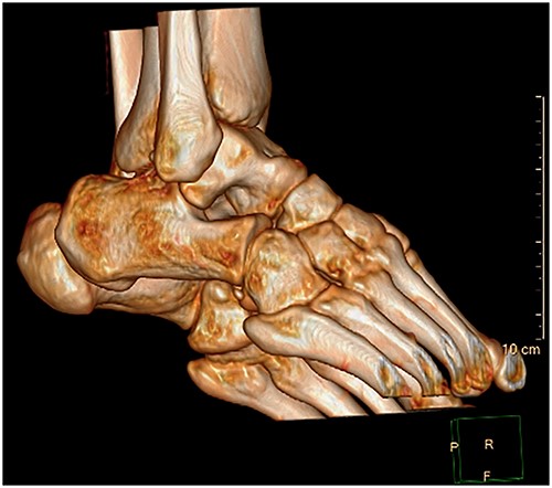 3D CT reconstruction.
