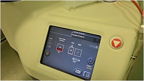 Monitoring of the bone marrow concentrate.