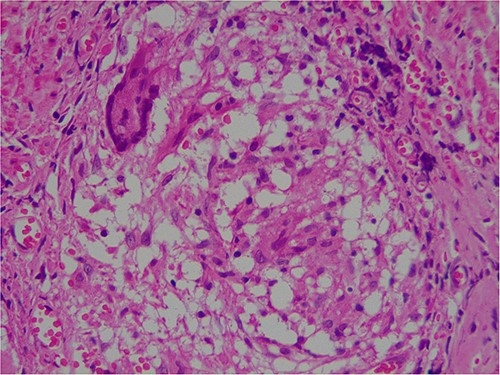 Microscopic image of giant cells.