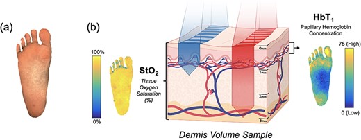 Oxygenation and perfusion maps using SFDI in an example plantar foot; (a) depicts the sampling of tissue reflectance at visible and near-infrared wavelengths; (b) shows maps of the tissue oxygen saturation (StO2) and the papillary/superficial hemoglobin concentration (HbT1) from the representative volume of skin tissue.