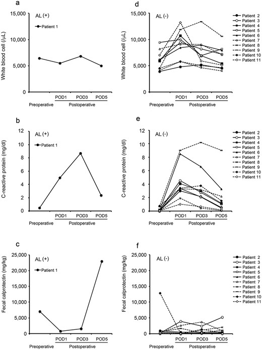 Perioperative values of inflammatory markers and FC in all patients; white blood cell count (a), CRP (b) and FC (c) in patient with AL; white blood cell count (d), CRP (e) and FC (f) in patient without AL.