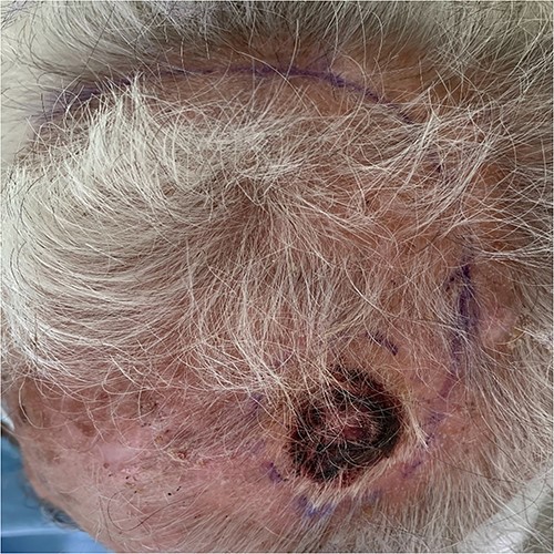 Macroscopic appearance.