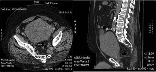 Axial and sagittal CT images.