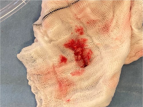 Excised vegetation on a white swab.