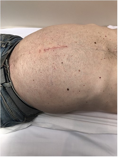 Pre-operative examination.