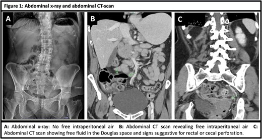 Abdominal X-ray and abdominal CT scan images.