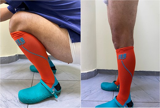 The patient’s range of motion (5 months after surgery).