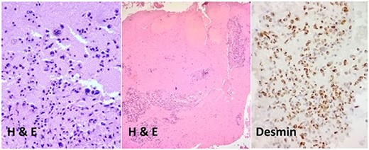 Histopathological examination of the tumor cells.