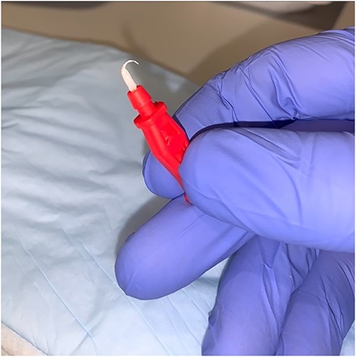 Catheter hub twisted off from the body of the catheter.