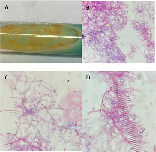 (A) Colonies grown in broth medium using modified Kinyoun stain. (B–D) Light microscopy features filamentous branching rods stained acid fast positive due to the mycolic acid present in cell walls.