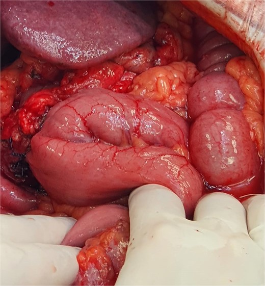 View of the reconstruction.