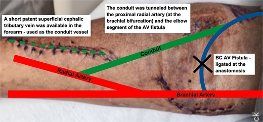 Schematic representation of RUDI. procedure