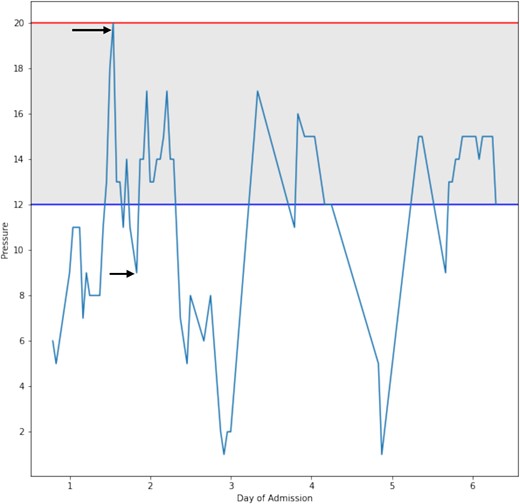 Shows a graphical representation of the change in intra-abdominal pressure that occurred during the resuscitation period. The arrows represent IAP 20 mmHg before intervention and 9 mmHg after intervention.
