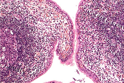 Postoperative paraffin-embedded pathology slide.