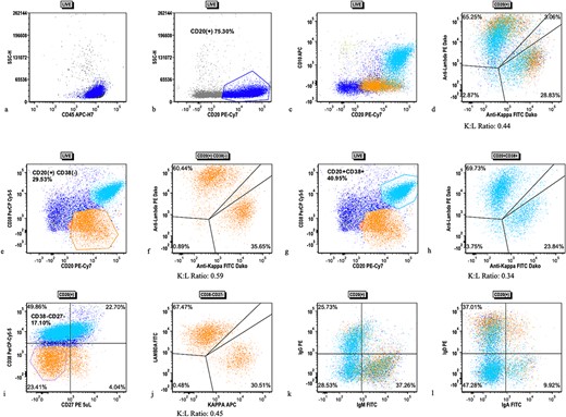 Flow cytometric analysis scatter plots from case 1 tonsillectomy. Flow cytometric analysis scatter plots showing (a) live gate with mostly CD45(+) lymphocytes, (b) CD20(+) B cells (dark blue), (c) subpopulation of CD10(+), CD38(+) B cells, (d) kappa/lambda surface light chain expression on all CD20(+) B cells, (e) gating of CD38(−) (orange) B cells, (f) kappa/lambda surface light chain expression on CD38(−) B cells, (g) gating of CD38(+) B cells (cyan), (h) kappa/lambda surface light chain expression on CD38(+) B cells, (i) CD27 expression on all CD20(+) B cells with gating of CD38(−), CD27(−) population, (j) kappa/lambda surface light chain expression on CD27(−), CD38(−) B cells, (k) IgM and IgD expression on B cells, and (l) IgG and IgA expression on B cells.