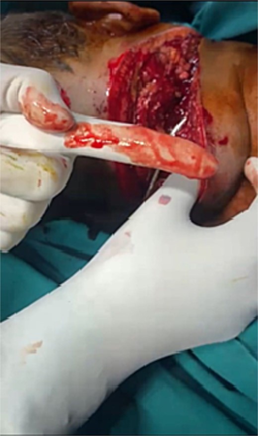 Picture showing the depth of the cut with respect to the finger length.