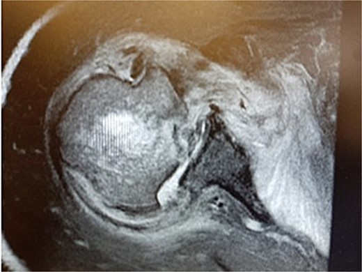 MRI image.
