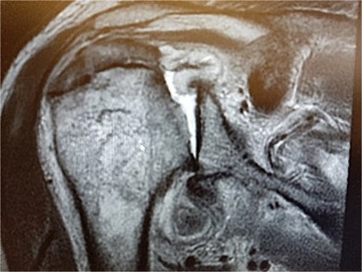 MRI image.