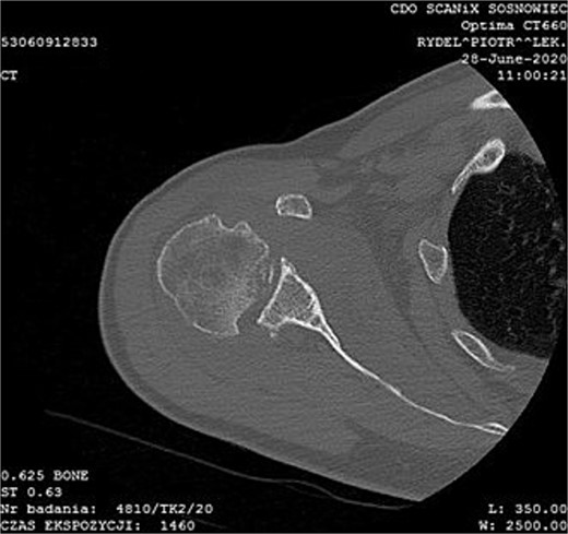 CT image.