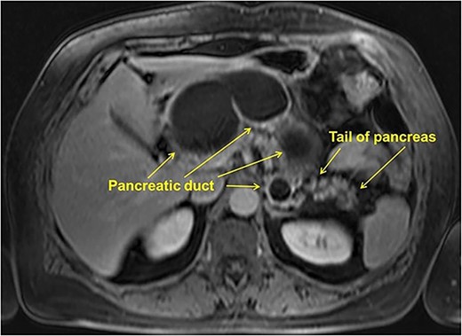 MRI. Axial, T1-weighted image.