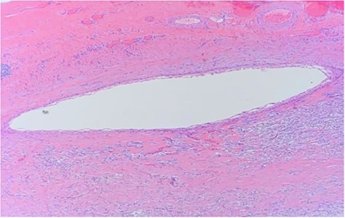 Close up of squamous epithelium.
