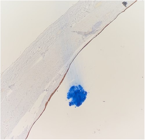 Squamous epithelium demonstrating CK staining.