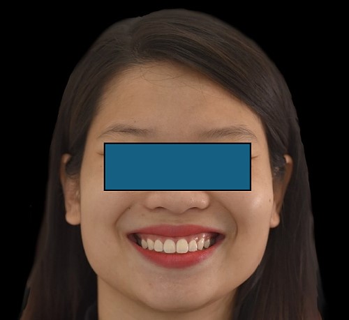 Postoperative results at 12 months.