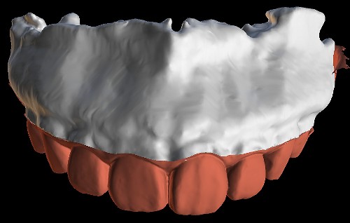 Demonstrates the manipulable STL model.