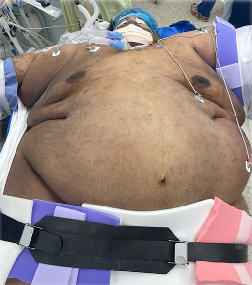 Patient positioning.