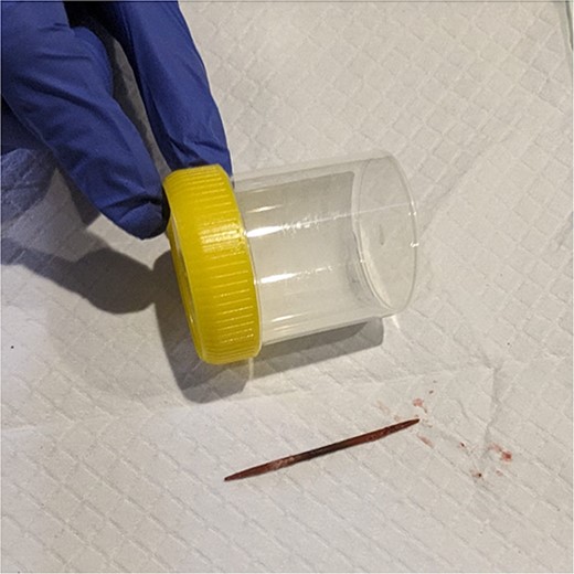 Toothpick after retrieval.