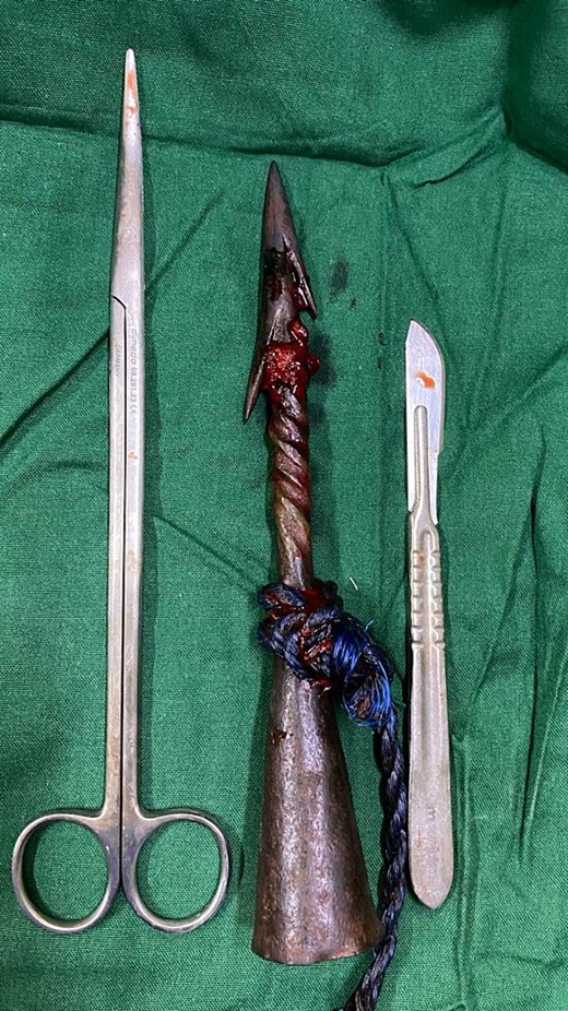 Shows the antique African iron spear after removal.
