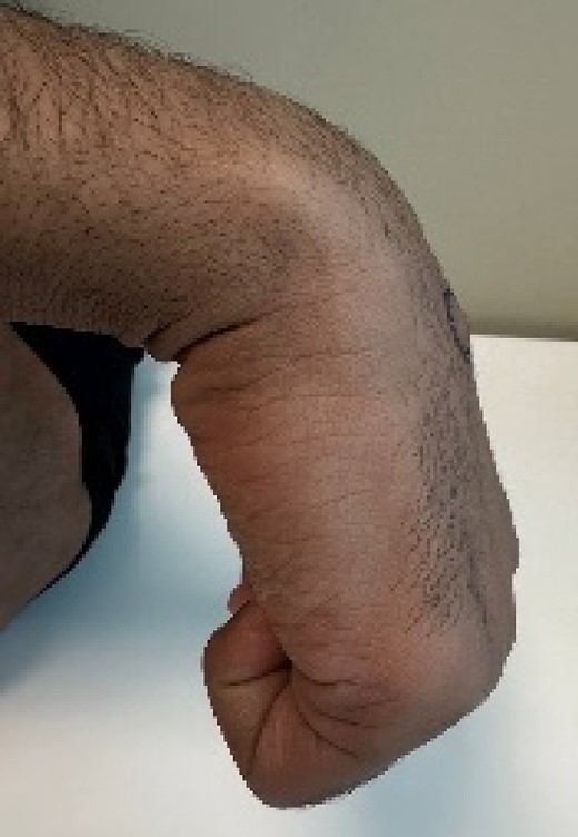 Pre-operative hand and wrist examination.