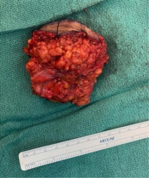 Oval yellow-tan mass measuring 7 × 6 × 4 cm.