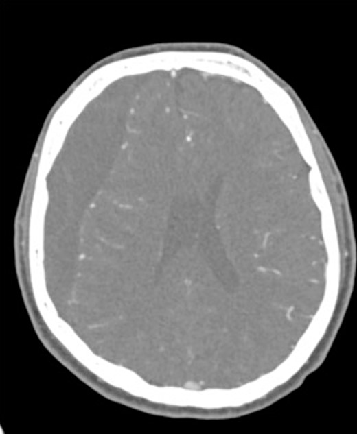 Preoperative CT imaging from Case 1.